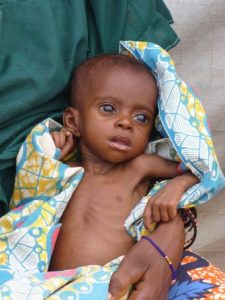 アフリカ　飢餓ベルト『サヘル』 止まらない砂漠化 紛争が強いる人口移動 飢餓1,500万人超